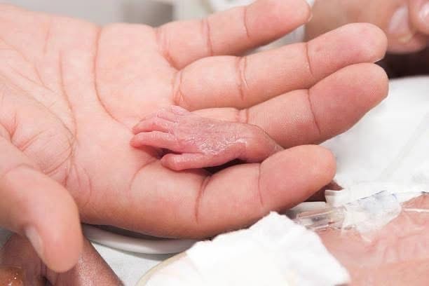 A premature newborn's tiny hand resting in a parent's palm in the NICU